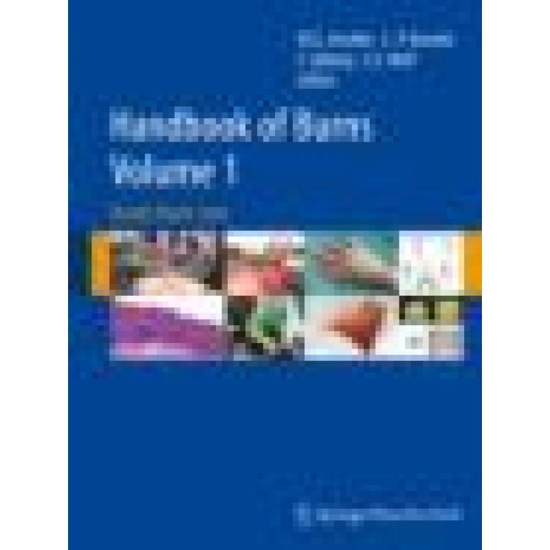 Handbook of Burns Volume 1